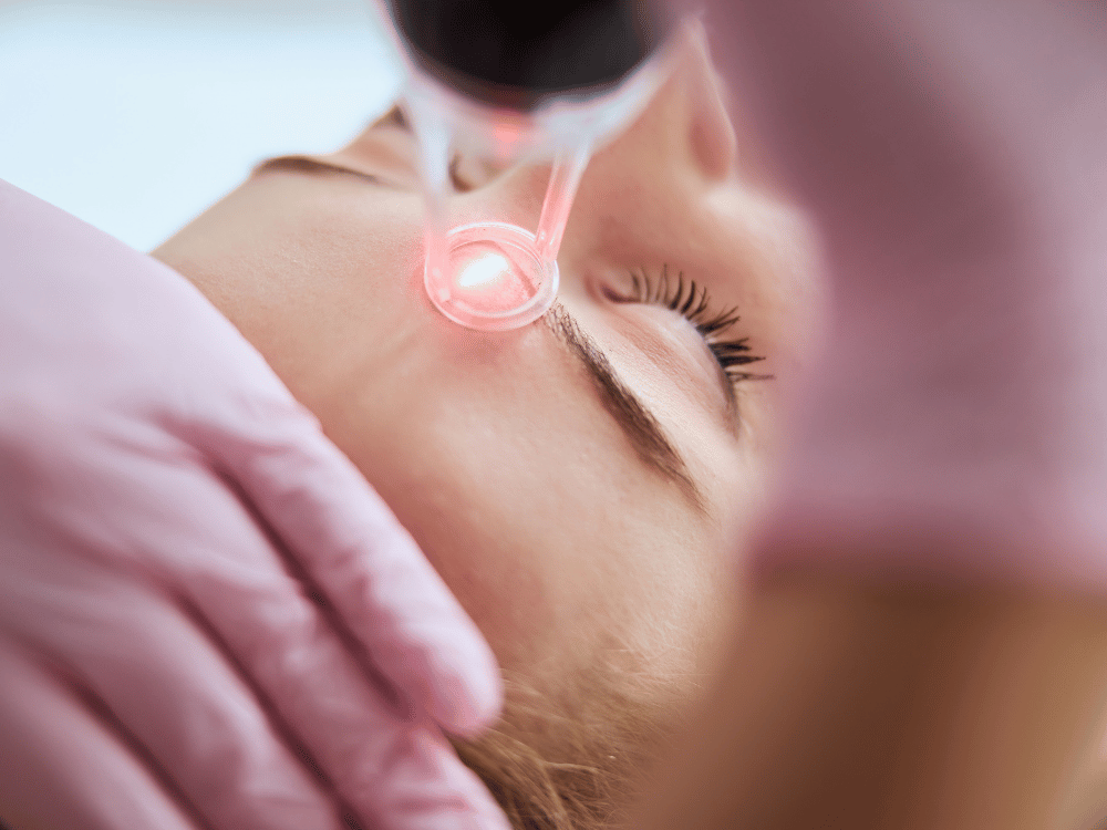 Tratamento facial com tecnologia Lavieen